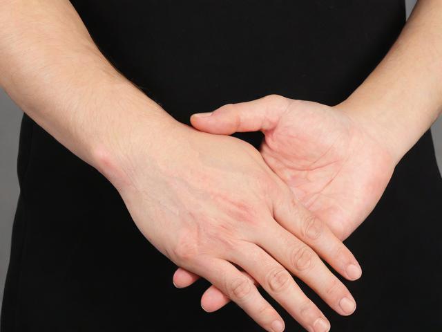 河南做狐臭大概多少钱？揭秘狐臭手术费用与选择