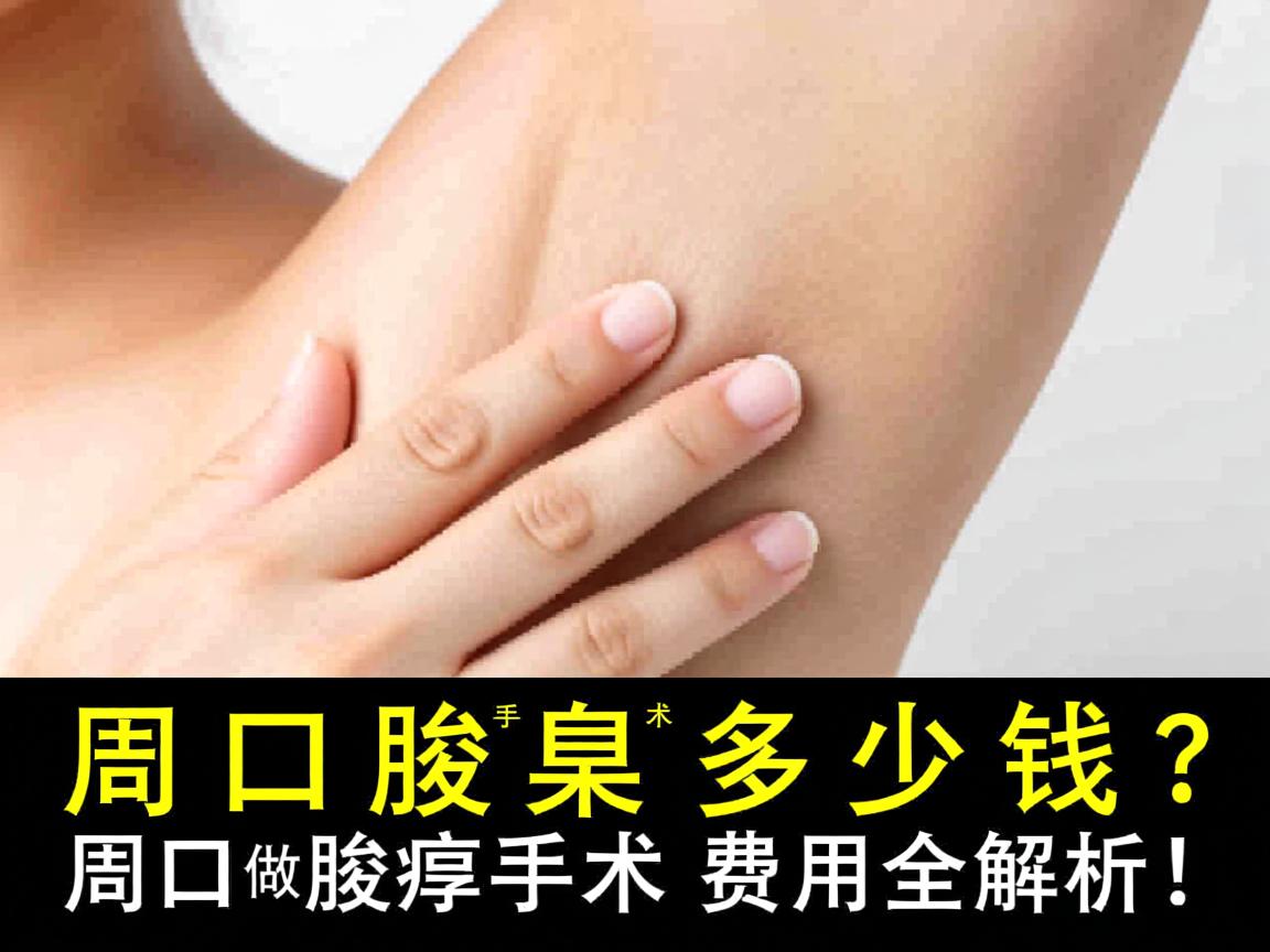 周口腋臭手术多少钱？周口做腋臭手术费用全解析！