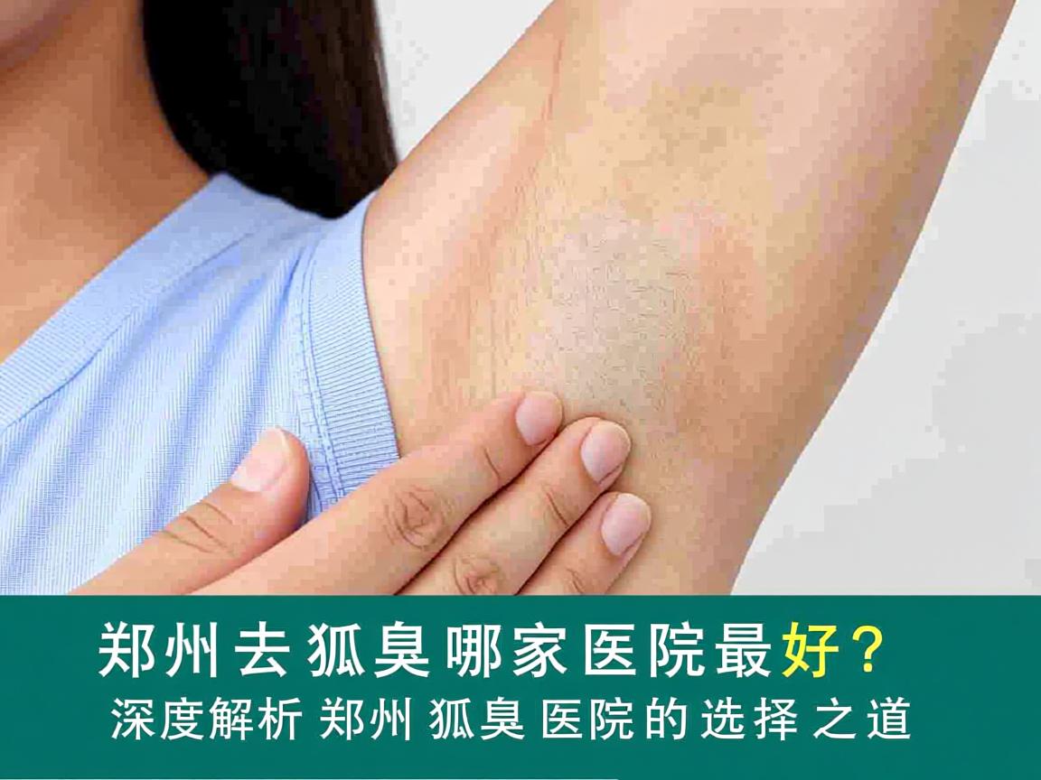 郑州去狐臭哪家医院最好?深度解析郑州狐臭医院的选择之道 郑州去狐臭哪家医院最好?深度解析郑州狐臭医院的选择之道