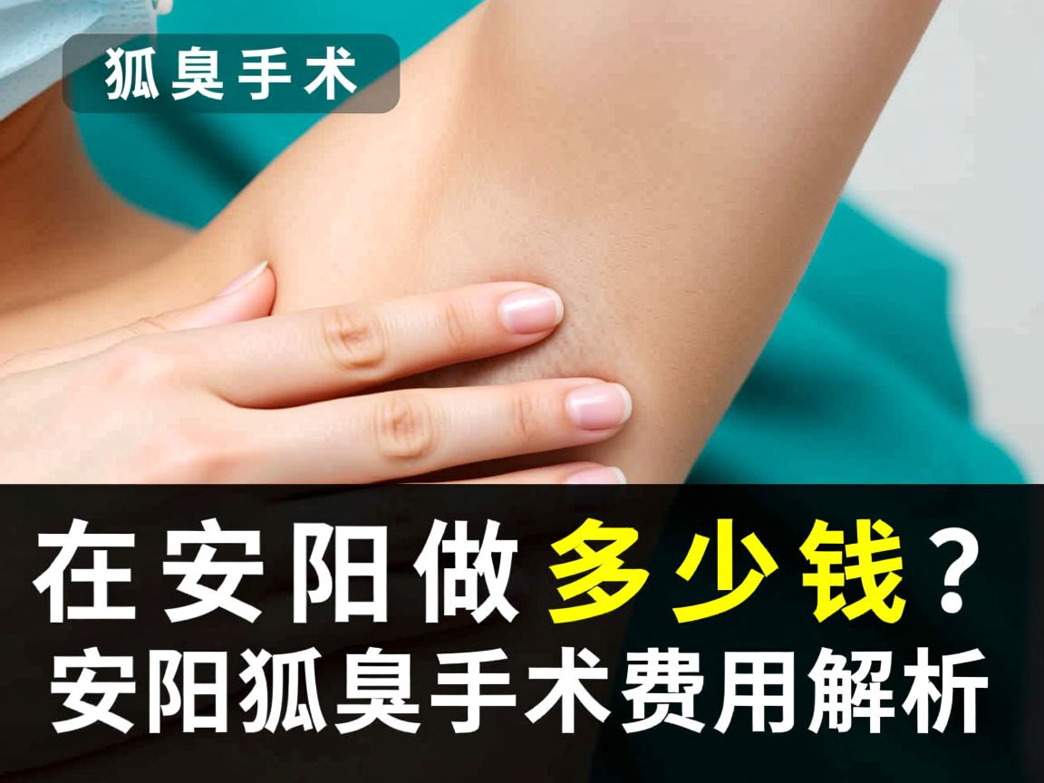 狐臭手术在安阳做多少钱?安阳狐臭手术费用解析 狐臭手术在安阳做多少钱?安阳狐臭手术费用解析