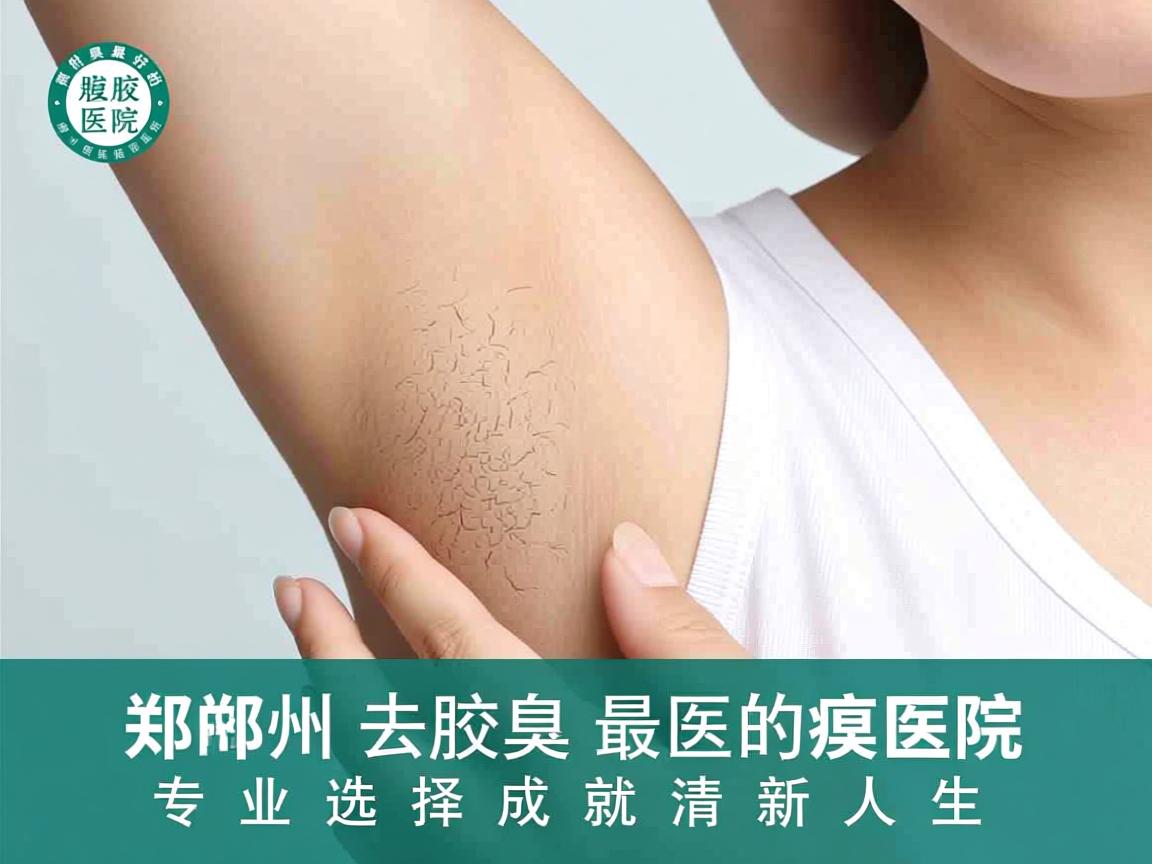 郑州去腋臭最好的医院,郑州附医腋臭医院,专业选择成就清新人生 郑州去腋臭最好的医院,郑州附医腋臭医院,专业选择成就清新人生