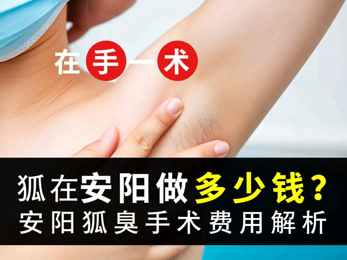 狐臭手术在安阳做多少钱？安阳狐臭手术费用解析