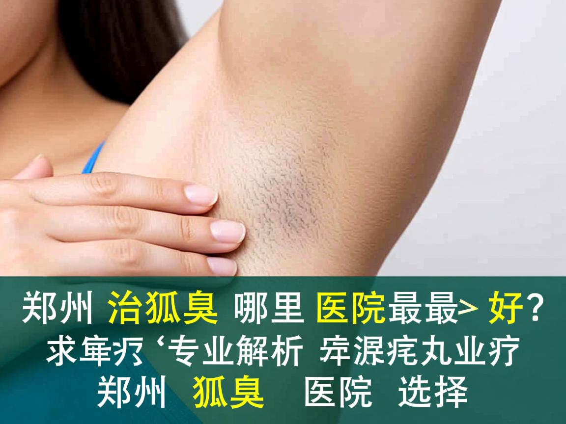 郑州治狐臭哪里医院最好?专业解析郑州狐臭医院选择 郑州治狐臭哪里医院最好?专业解析郑州狐臭医院选择