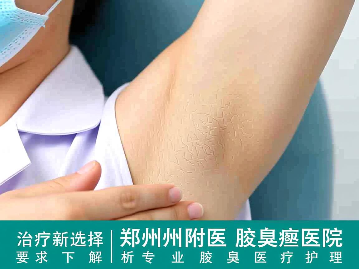 腋臭治疗新选择，郑州附医腋臭医院解析专业腋臭医疗护理
