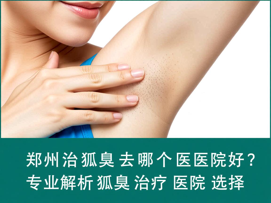 郑州治狐臭去哪个医院好？专业解析狐臭治疗医院的选择