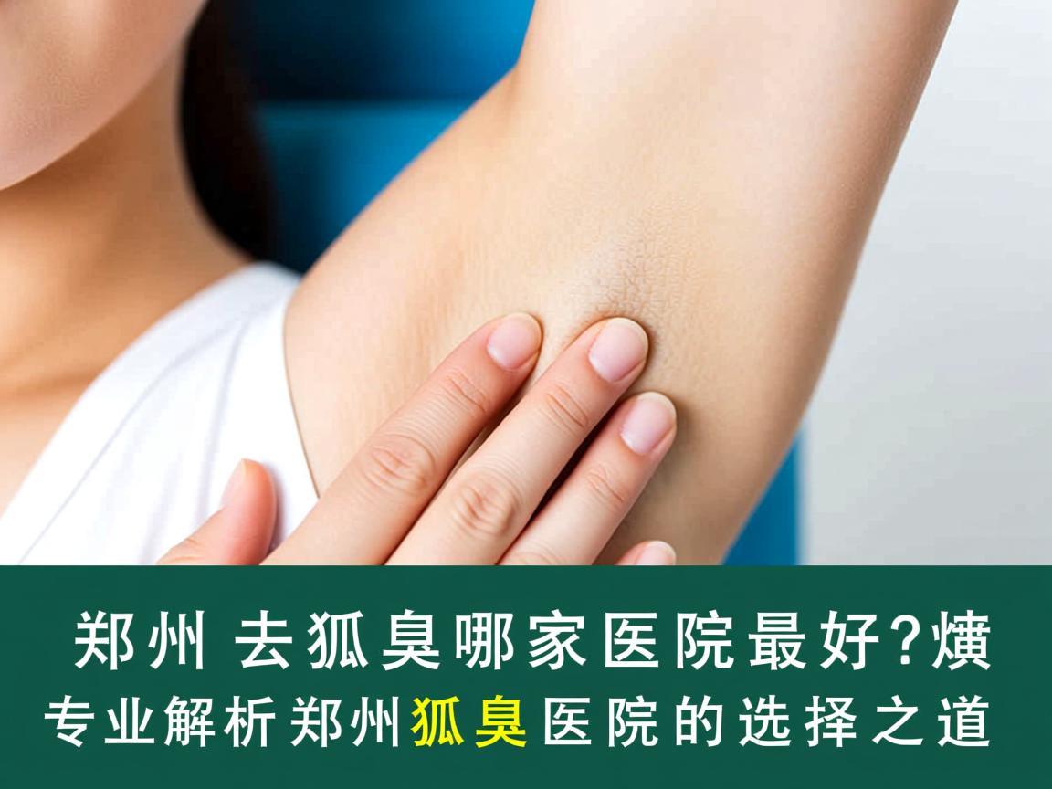 郑州去狐臭哪家医院最好？专业解析郑州狐臭医院的选择之道