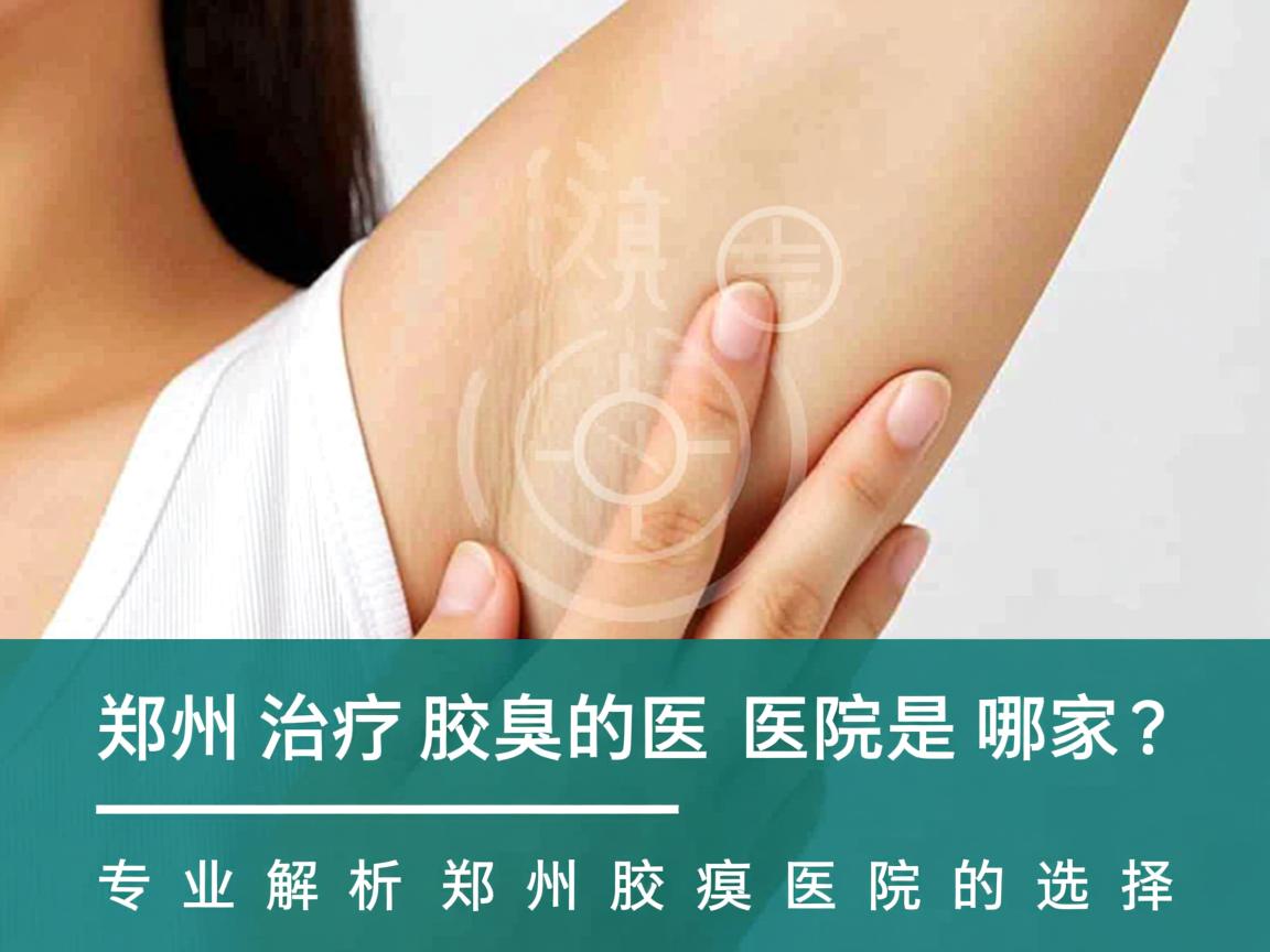 郑州治疗腋臭的医院是哪家？专业解析郑州腋臭医院的选择