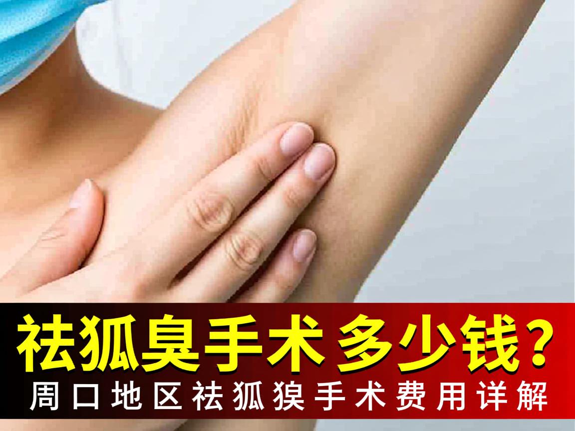 祛狐臭手术多少钱?周口地区祛狐臭手术费用详解 祛狐臭手术多少钱?周口地区祛狐臭手术费用详解